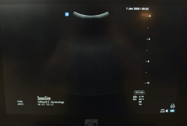 FujiFilm SonoSite X-Port C60xp/5-2 MHz Curved Array Ultrasound Transducer P14561-20