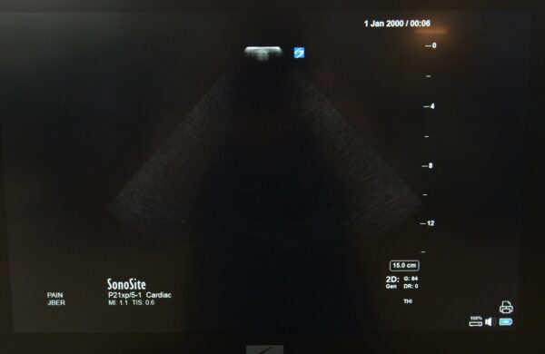 FujiFilm Sonosite X-Porte P21xp/5-1 MHz Ultrasound Transducer P14563-20