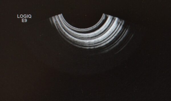 GE RIC5-9-D Wide Band Convex Array Endocavitary 4D Volume Ultrasound Transducer H48651MS