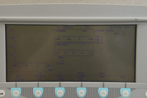 Grason Stadler GSI TympStar 2000-97XX Middle Ear Analyzer