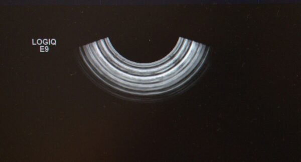 GE RIC5-9-D Wide Band Convex Array Endocavitary 4D Volume Ultrasound Transducer H48651MS