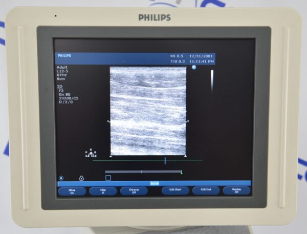 Philips HD11 XE Ultrasound System W/ Philips L12-5 & S3-1 Probes