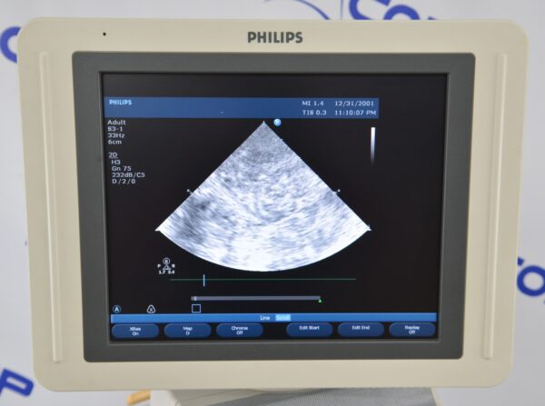 Philips HD11 XE Ultrasound System W/ Philips L12-5 & S3-1 Probes