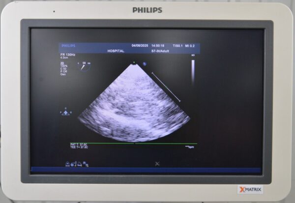 Philips S7-3t TEE Sector Array Cardiology Pediatric Ultrasound Transducer