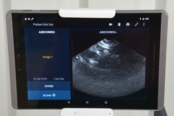 EchoNous Uscan Sector Probe R003992 W/ HP Pro Slate 8 Tablet & Cart