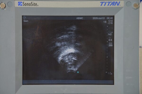 SonoSite Titan High-Resolution Ultrasound System W/ C15/4-2 MHz Transducer Prob & Cart