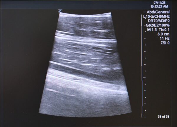 Zonare Ultra Z.one Diagnostic Ultrasound System W/ C6-2 Transducer, L10-5 Transducer, Z.one Scan Engine & SmartCart