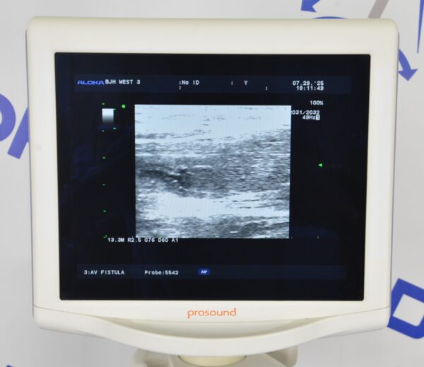 Aloka Prosound Alpha 6 Ultrasound System W/ Aloka UST-5542 Transducer