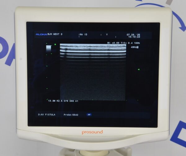 Aloka Prosound Alpha 6 Ultrasound System W/ Aloka UST-5542 Transducer