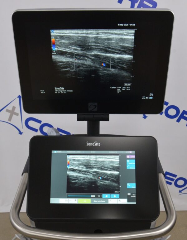 Fujifilm Sonosite X-Porte Ultrasound System W/ C60xp/5-2, HFL50xp/15-6, L25xp/13-6 Transducers