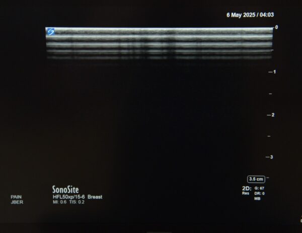 Fujifilm Sonosite X-Porte Ultrasound System W/ C60xp/5-2, HFL50xp/15-6, L25xp/13-6 Transducers