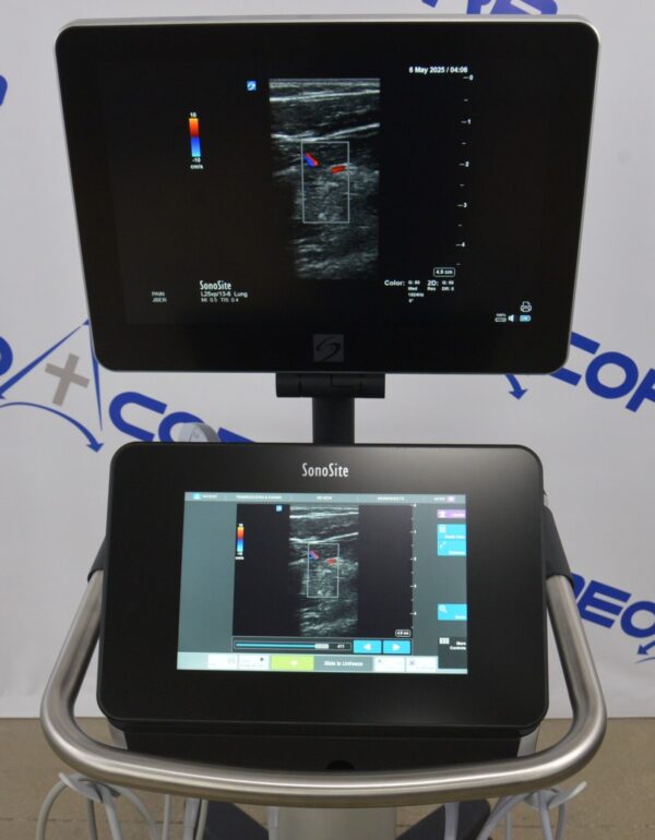 Fujifilm Sonosite X-Porte Ultrasound System W/ C60xp/5-2, HFL50xp/15-6, L25xp/13-6 Transducers