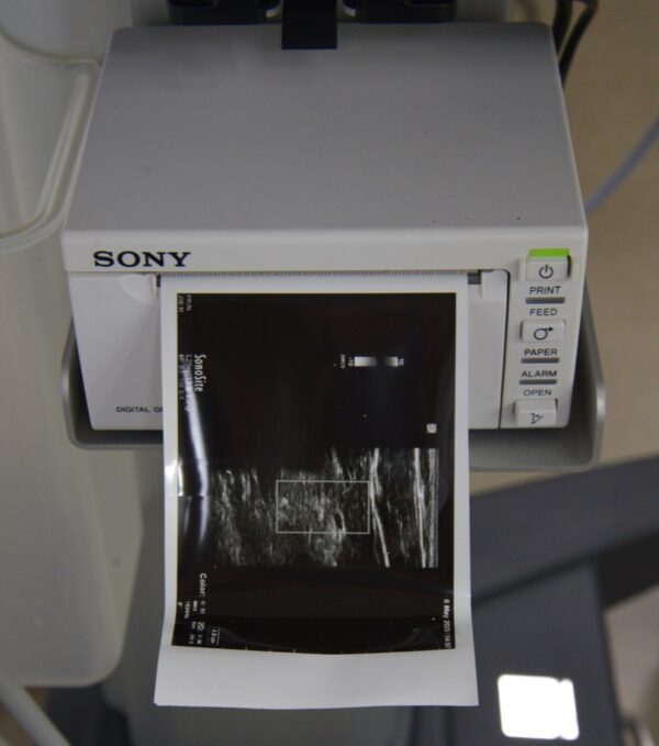 Fujifilm Sonosite X-Porte Ultrasound System W/ C60xp/5-2, HFL50xp/15-6, L25xp/13-6 Transducers