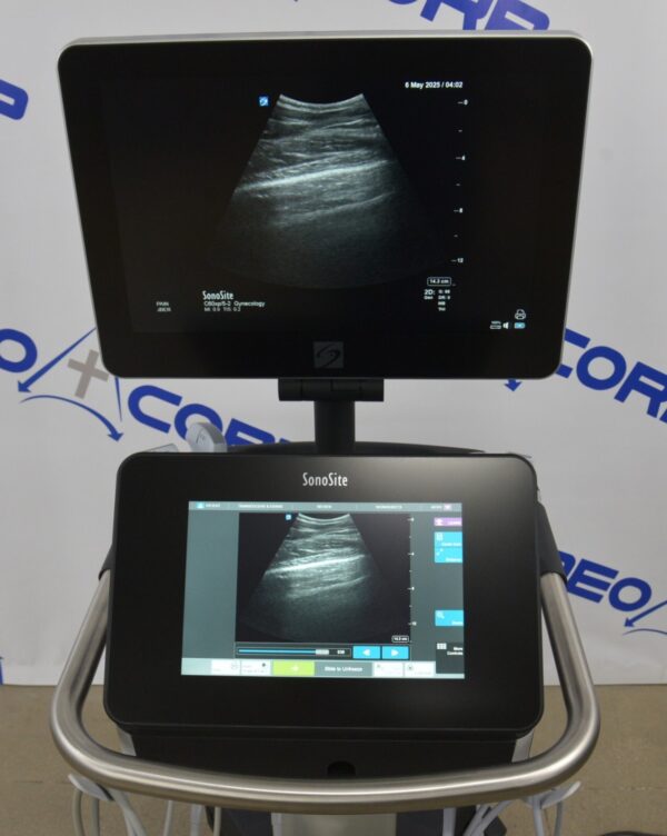 Fujifilm Sonosite X-Porte Ultrasound System W/ C60xp/5-2, HFL50xp/15-6, L25xp/13-6 Transducers