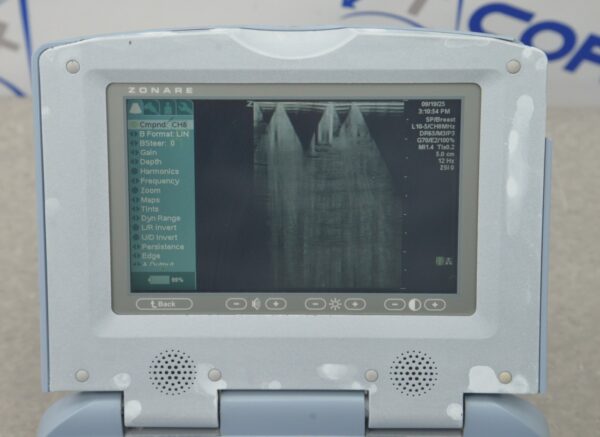 Zonare Ultra Z.one Diagnostic Ultrasound System W/ L10-5 Transducer, Z.one Scan Engine & SmartCart