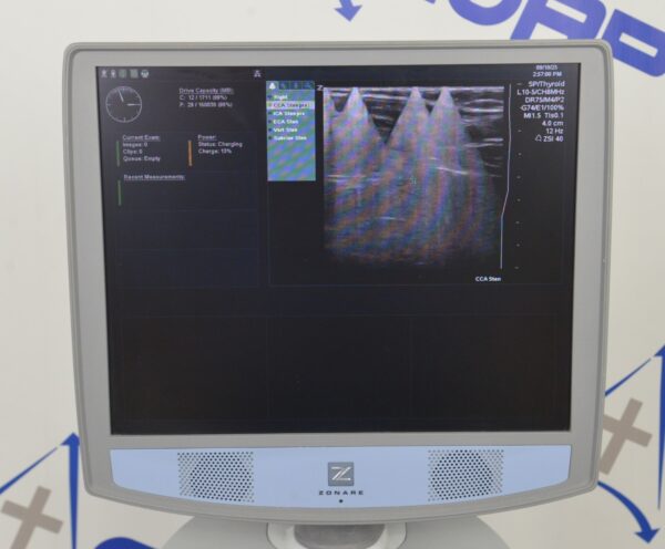 Zonare Ultra Z.one Diagnostic Ultrasound System W/ L10-5 Transducer, Z.one Scan Engine & SmartCart