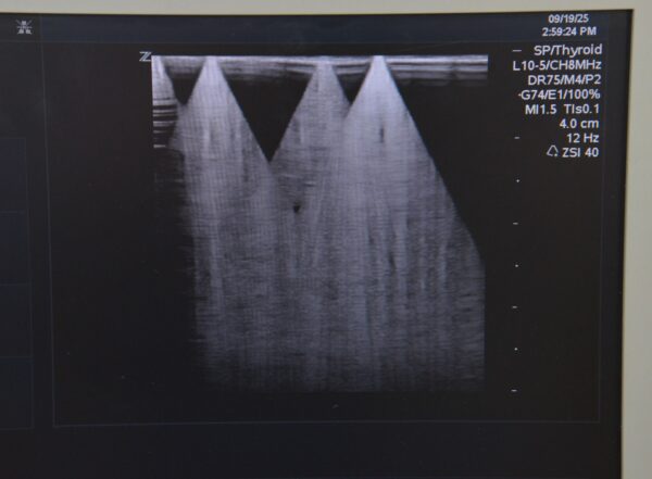 Zonare Ultra Z.one Diagnostic Ultrasound System W/ L10-5 Transducer, Z.one Scan Engine & SmartCart