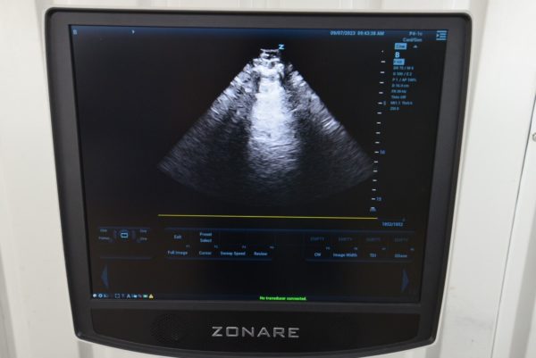 Zonare Mindray ZS3 Ultrasound System REF 88000-00 with Mobile Cart