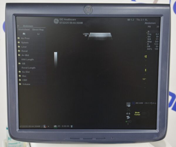 GE Logiq E9 Ultrasound System 5205000-5 W/ C1-5 & 9L-D Transducers