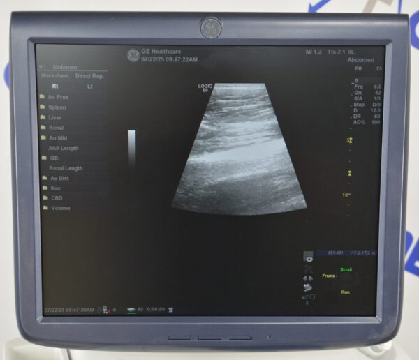 GE Logiq E9 Ultrasound System 5205000-5 W/ C1-5 & 9L-D Transducers
