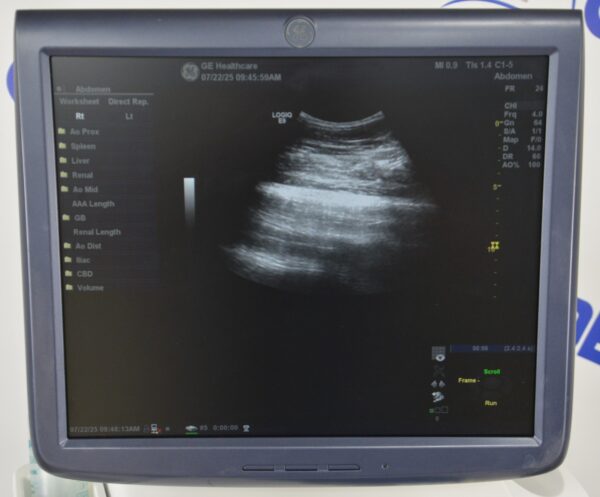 GE Logiq E9 Ultrasound System 5205000-5 W/ C1-5 & 9L-D Transducers