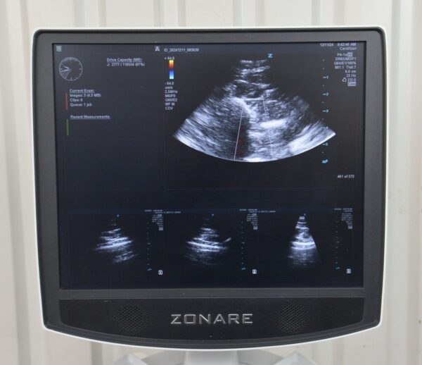 Zonare Mindray ZS3 Ultrasound System REF 88000-00 W/ Zonare P4-1c Transducer