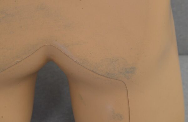 Blue Phantom Scrotal Ultrasound Training Model