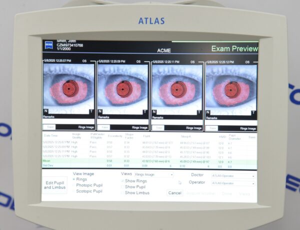 Carl Zeiss Atlas 9000 Corneal Topographer w/ Windows 7